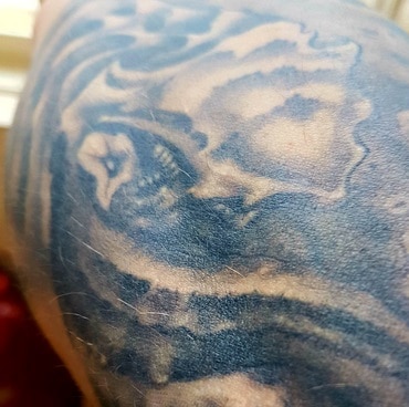 neues Tattoo sieht blau aus
